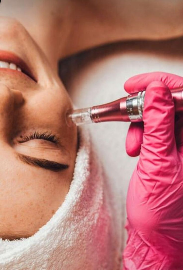 Microneedling Magic: Uplifting Your Skin's Beauty