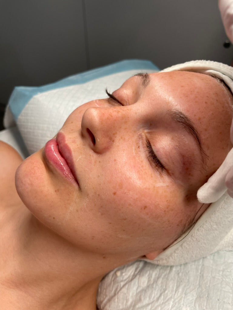 What to Ask Yourself Before Considering Cosmetic Injectable Treatments
